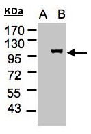 IPO13 / LGL2 Antibody - Western blot of IPO13 expression in transfected 293T cell line by IPO13 polyclonal antibody. A: Non-transfected lysate., B: IPO13 transfected lysate. 7.5% SDS PAGE. IPO13 / LGL2 antibody diluted at 1:500