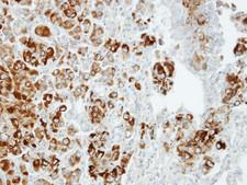 IPO13 / LGL2 Antibody - IHC of paraffin-embedded CL1-5 xenograft using Importin 13 antibody at 1:100 dilution.