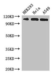 IPO13 / LGL2 Antibody - Western Blot Positive WB detected in: HEK293 whole cell lysate, Hela whole cell lysate, A549 whole cell lysate All lanes: IPO13 antibody at 3µg/ml Secondary Goat polyclonal to rabbit IgG at 1/50000 dilution Predicted band size: 109 kDa Observed band size: 109 kDa