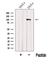 IPO13 / LGL2 Antibody - Western blot analysis of extracts of HeLa cells using IPO13 antibody. The lane on the left was treated with blocking peptide.