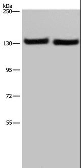 IPO4 Antibody - Western blot analysis of A549 cell and human testis tissue, using IPO4 Polyclonal Antibody at dilution of 1:550.