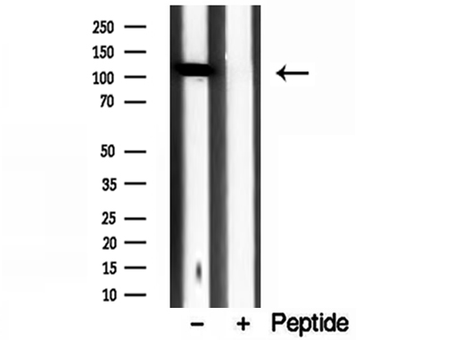 IPO4 Antibody - Western blot analysis of extracts of HeLa cells using IPO4 antibody.