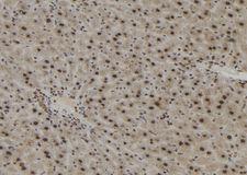 IPO4 Antibody - 1:100 staining mouse liver tissue by IHC-P. The sample was formaldehyde fixed and a heat mediated antigen retrieval step in citrate buffer was performed. The sample was then blocked and incubated with the antibody for 1.5 hours at 22°C. An HRP conjugated goat anti-rabbit antibody was used as the secondary.
