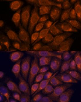 IPO4 Antibody - Immunofluorescence analysis of HeLa cells using IPO4 Polyclonal Antibody at dilution of 1:100.Blue: DAPI for nuclear staining.