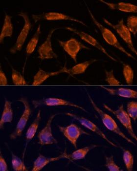 IPO4 Antibody - Immunofluorescence analysis of L929 cells using IPO4 Polyclonal Antibody at dilution of 1:100.Blue: DAPI for nuclear staining.