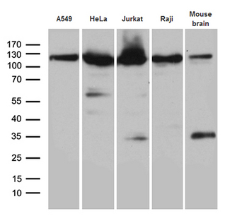 IPO5 / RANBP5 Antibody - Western blot analysis of extracts. (35ug) from 4 cell lines and mouse brain tissue lysate by using anti-IPO5 monoclonal antibody. (1:2000)