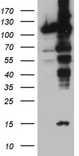 IPO5 / RANBP5 Antibody - HEK293T cells were transfected with the pCMV6-ENTRY control. (Left lane) or pCMV6-ENTRY IPO5. (Right lane) cDNA for 48 hrs and lysed