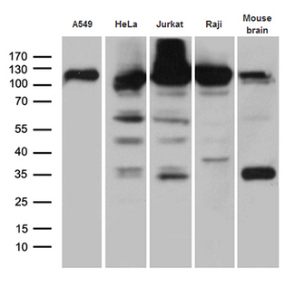 IPO5 / RANBP5 Antibody - Western blot analysis of extracts. (35ug) from 4 cell lines and mouse brain tissue lysate by using anti-IPO5 monoclonal antibody. (1:500)