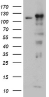 IPO5 / RANBP5 Antibody - HEK293T cells were transfected with the pCMV6-ENTRY control. (Left lane) or pCMV6-ENTRY IPO5. (Right lane) cDNA for 48 hrs and lysed