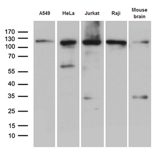 IPO5 / RANBP5 Antibody - Western blot analysis of extracts. (35ug) from 4 cell lines and mouse brain tissue lysates by using anti-IPO5 monoclonal antibody. (1:500)