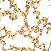 IPO5 / RANBP5 Antibody - Immunohistochemistry of paraffin-embedded mouse lung tissue.
