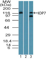 IPO7 / RANBP7 Antibody - Western blot ofIOP7 inMCF7 cell lysate in the 1) absence and2) presence of immunizing peptide, and 3) RAW cell lysate using Polyclonal Antibody to Importin-7 (IOP7) at 1 ug/ml. Goat anti-rabbit Ig HRP secondary antibody, and PicoTect ECL substrate solution were used for this test.