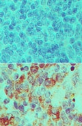 IPO7 / RANBP7 Antibody - IHC of IOP7 in formalin-fixed, paraffin-embedded mouse spleen tissue using an isotype control (top) and Polyclonal Antibody to Importin-7 (IOP7) (bottom) at 5 ug/ml.