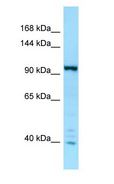 IPO7 / RANBP7 Antibody - IPO7 / RANBP7 antibody Western Blot of MCF7.  This image was taken for the unconjugated form of this product. Other forms have not been tested.