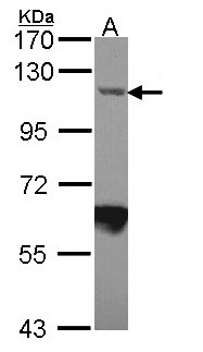 IPO7 / RANBP7 Antibody - Sample (30 ug of whole cell lysate). A: JurKat. 7.5% SDS PAGE. IPO7 / RANBP7 antibody diluted at 1:1000.
