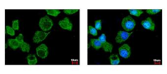 IPO7 / RANBP7 Antibody - Importin 7 antibody [C3], C-term detects IPO7 protein at cytoplasm by immunofluorescent analysis. A431 cells were fixed in 4% paraformaldehyde at RT for 15 min. IPO7 protein stained by Importin 7 antibody [C3], C-term diluted at 1:500. 