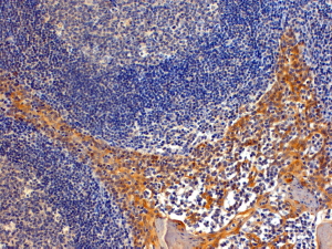 IPO8 / Importin 8 Antibody - Goat Anti-RANBP8 / IPO8 Antibody (4µg/ml) staining of paraffin embedded Human Tonsil. Steamed antigen retrieval with Tris/EDTA buffer pH 9, HRP-staining. Similar results were obtained after antigen retrieval at pH9.