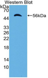 IPO8 / Importin 8 Antibody - Western blot of recombinant IPO8 / Importin 8.