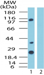IPO8 / Importin 8 Antibody - Western blot of human Importin-8inHeLa cell lysate in the 1) absence and 2) presence of immunizing peptide using antibody at1 ug/ml.