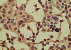 IPO8 / Importin 8 Antibody - ICC staining of HeLa cells using antibody (Importin-8) at 5 ug/ml.