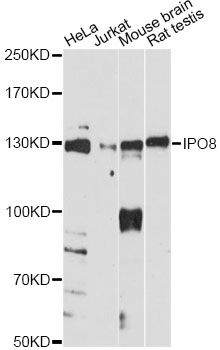 IPO8 / Importin 8 Antibody - Western blot analysis of extracts of various cell lines, using IPO8 antibody at 1:1000 dilution. The secondary antibody used was an HRP Goat Anti-Rabbit IgG (H+L) at 1:10000 dilution. Lysates were loaded 25ug per lane and 3% nonfat dry milk in TBST was used for blocking. An ECL Kit was used for detection and the exposure time was 60s.