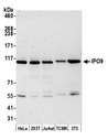 IPO9 / Importin 9 Antibody - Detection of human and mouse IPO9 by western blot. Samples: Whole cell lysate (15 µg) from HeLa, HEK293T, Jurkat, mouse TCMK-1, and mouse NIH 3T3 cells prepared using NETN lysis buffer. Antibody: Affinity purified rabbit anti-IPO9 antibody used for WB at 0.1 µg/ml. Detection: Chemiluminescence with an exposure time of 75 seconds.