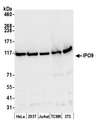 IPO9 / Importin 9 Antibody - Detection of human and mouse IPO9 by western blot. Samples: Whole cell lysate (50 µg) from HeLa, HEK293T, Jurkat, mouse TCMK-1, and mouse NIH 3T3 cells prepared using NETN lysis buffer. Antibody: Affinity purified rabbit anti-IPO9 antibody used for WB at 0.1 µg/ml. Detection: Chemiluminescence with an exposure time of 10 seconds.
