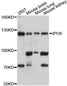 IPO9 / Importin 9 Antibody - Western blot analysis of extracts of various cell lines, using IPO9 antibody at 1:3000 dilution. The secondary antibody used was an HRP Goat Anti-Rabbit IgG (H+L) at 1:10000 dilution. Lysates were loaded 25ug per lane and 3% nonfat dry milk in TBST was used for blocking. An ECL Kit was used for detection and the exposure time was 5s.