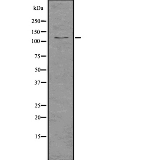IPO9 / Importin 9 Antibody - Western blot analysis of IPO9 using COLO205 whole lysates.
