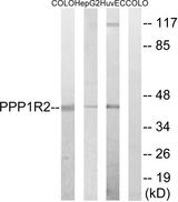 IPP2 / PPP1R2 Antibody - Western blot analysis of lysates from HUVEC, HepG2, and COLO cells, using PPP1R2 Antibody. The lane on the right is blocked with the synthesized peptide.