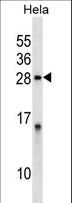 IPP2 / PPP1R2 Antibody - PPP1R2 Antibody western blot of HeLa cell line lysates (35 ug/lane). The PPP1R2 antibody detected the PPP1R2 protein (arrow).