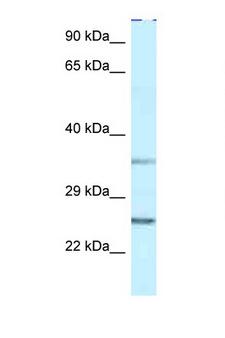 IPP2 / PPP1R2 Antibody - PPP1R2 antibody Western blot of 1 Cell lysate. Antibody concentration 1 ug/ml.  This image was taken for the unconjugated form of this product. Other forms have not been tested.