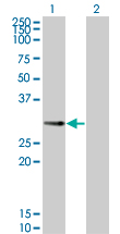 IPP2 / PPP1R2 Antibody - Western blot of PPP1R2P3 expression in transfected 293T cell line by PPP1R2P3 monoclonal antibody (M01), clone 2G11.