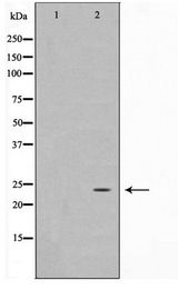 IPP2 / PPP1R2 Antibody - Western blot of Jurkat cell lysate using PPP1R2 Antibody