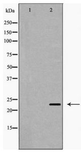 IPP2 / PPP1R2 Antibody - Western blot of PPP1R2 expression in Jurkat cells