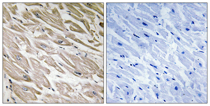 IPP2 / PPP1R2 Antibody - Immunohistochemistry analysis of paraffin-embedded human heart, using PPP1R2 (Phospho-Ser120+Ser121) Antibody. The picture on the right is blocked with the phospho peptide.