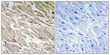 IPP2 / PPP1R2 Antibody - Immunohistochemistry analysis of paraffin-embedded human heart, using PPP1R2 (Phospho-Ser120+Ser121) Antibody. The picture on the right is blocked with the phospho peptide.