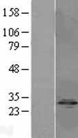 IPP2 / PPP1R2 Protein - Western validation with an anti-DDK antibody * L: Control HEK293 lysate R: Over-expression lysate