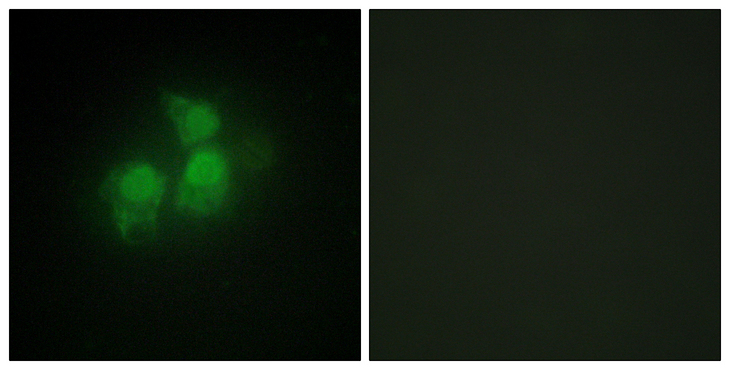 IPPK Antibody - Immunofluorescence analysis of HepG2 cells, using IPPK Antibody. The picture on the right is blocked with the synthesized peptide.