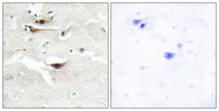 IPPK Antibody - Immunohistochemistry analysis of paraffin-embedded human brain tissue, using IPPK Antibody. The picture on the right is blocked with the synthesized peptide.