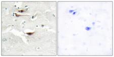 IPPK Antibody - Immunohistochemistry analysis of paraffin-embedded human brain tissue, using IPPK Antibody. The picture on the right is blocked with the synthesized peptide.