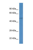 IPPK Antibody - IPPK antibody Western blot of Mouse Liver lysate. Antibody concentration 1 ug/ml. This image was taken for the unconjugated form of this product. Other forms have not been tested.