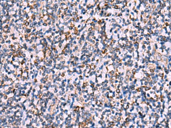 IPPK Antibody - Immunohistochemistry of paraffin-embedded Human tonsil tissue  using IPPK Polyclonal Antibody at dilution of 1:30(×200)