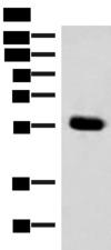 IPPK Antibody - Western blot analysis of Mouse pancreas tissue lysate  using IPPK Polyclonal Antibody at dilution of 1:350