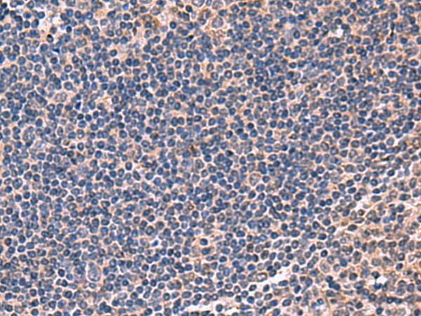IPPK Antibody - Immunohistochemistry of paraffin-embedded Human tonsil tissue  using IPPK Polyclonal Antibody at dilution of 1:50(×200)