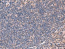 IPPK Antibody - Immunohistochemistry of paraffin-embedded Human tonsil tissue  using IPPK Polyclonal Antibody at dilution of 1:50(×200)