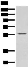IPPK Antibody - Western blot analysis of Jurkat cell lysate  using IPPK Polyclonal Antibody at dilution of 1:550