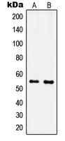 IPPK Antibody - Western blot analysis of IPPK expression in MCF7 (A); NIH3T3 (B) whole cell lysates.