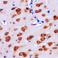 IPPK Antibody - Immunohistochemical analysis of IPPK staining in human brain formalin fixed paraffin embedded tissue section. The section was pre-treated using heat mediated antigen retrieval with sodium citrate buffer (pH 6.0). The section was then incubated with the antibody at room temperature and detected using an HRP conjugated compact polymer system. DAB was used as the chromogen. The section was then counterstained with hematoxylin and mounted with DPX.