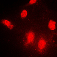 IPPK Antibody - Immunofluorescent analysis of IPPK staining in NIH3T3 cells. Formalin-fixed cells were permeabilized with 0.1% Triton X-100 in TBS for 5-10 minutes and blocked with 3% BSA-PBS for 30 minutes at room temperature. Cells were probed with the primary antibody in 3% BSA-PBS and incubated overnight at 4 C in a humidified chamber. Cells were washed with PBST and incubated with a DyLight 594-conjugated secondary antibody (red) in PBS at room temperature in the dark. DAPI was used to stain the cell nuclei (blue).